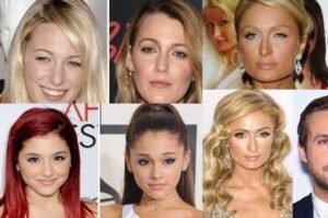 Read more about the article Celebrities With Ptosis – All About Droopy Eyelid